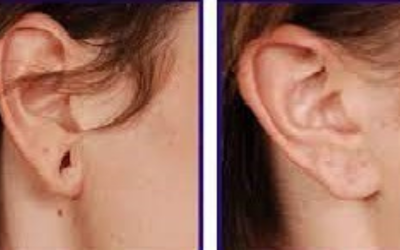 Earlobe